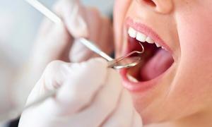 Lấy cao răng có thực sự làm trắng răng?